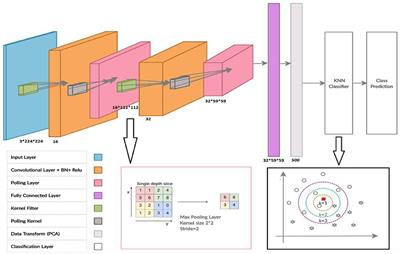 Hybrid HCNN-KNN Model Enhances <mark class="highlighted">Age Estimation</mark> Accuracy in Orthopantomography